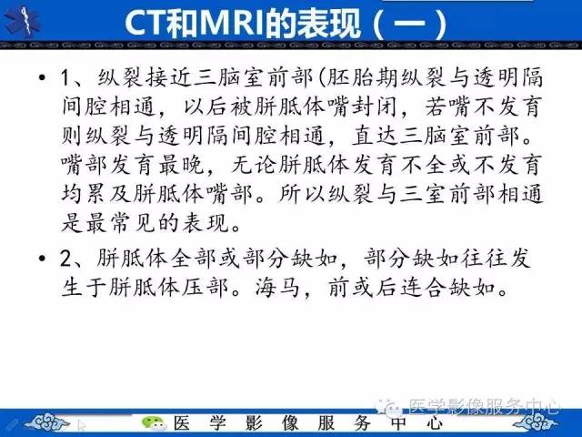 【影像征象】麋鹿头征and头盔征 ——胼胝体发育不全