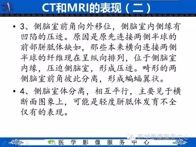 【影像征象】麋鹿头征and头盔征 ——胼胝体发育不全
