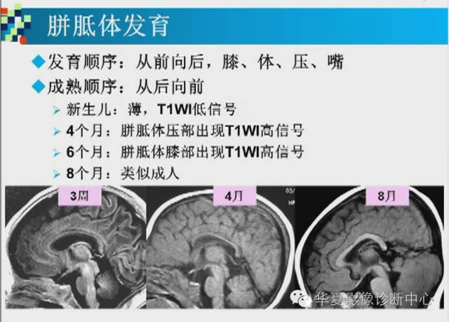 【PPT】胼胝体病变的MR诊断