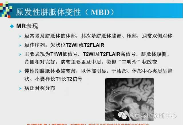【PPT】胼胝体病变的MR诊断