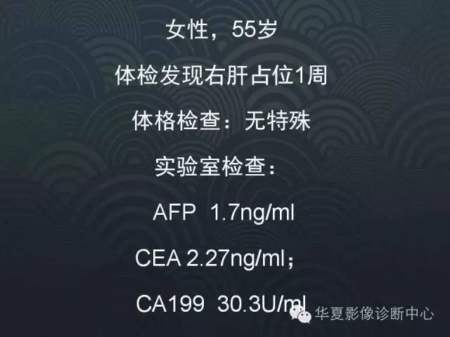 【病例】肝脏血管平滑肌脂肪瘤1例CT影像表现