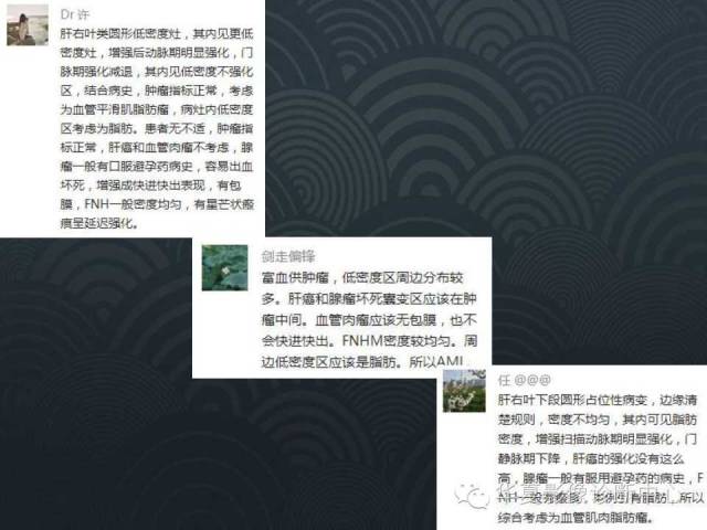 【病例】肝脏血管平滑肌脂肪瘤1例CT影像表现