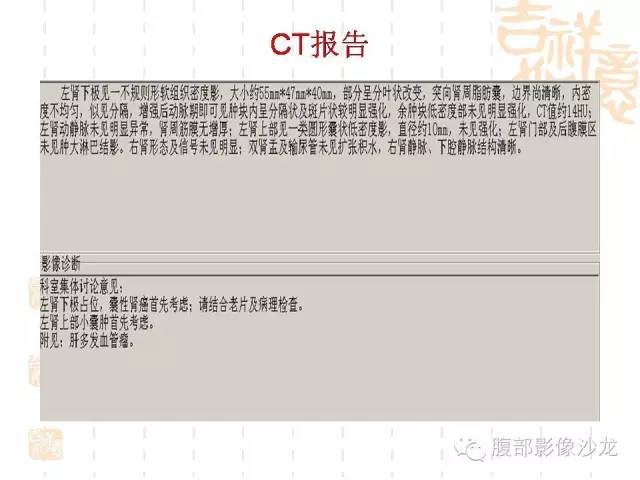 【PPT】肾囊实性病变分析 【PPT】肾囊实性病变分析