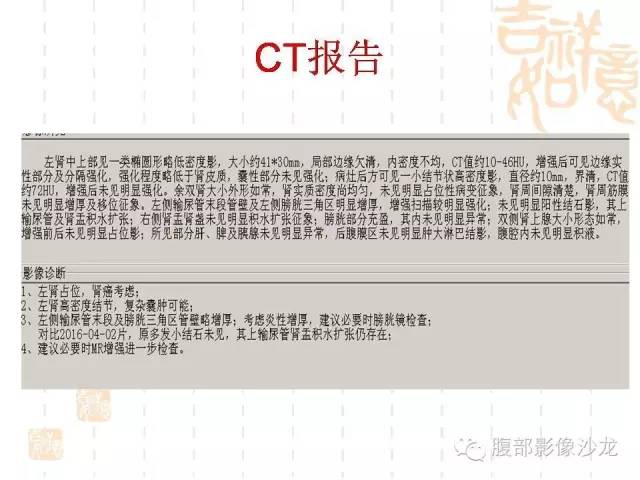 【PPT】肾囊实性病变分析 【PPT】肾囊实性病变分析