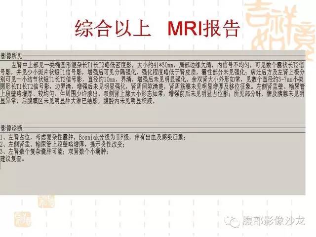 【PPT】肾囊实性病变分析 【PPT】肾囊实性病变分析