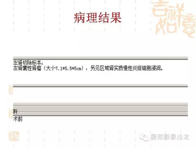 【PPT】肾囊实性病变分析 【PPT】肾囊实性病变分析