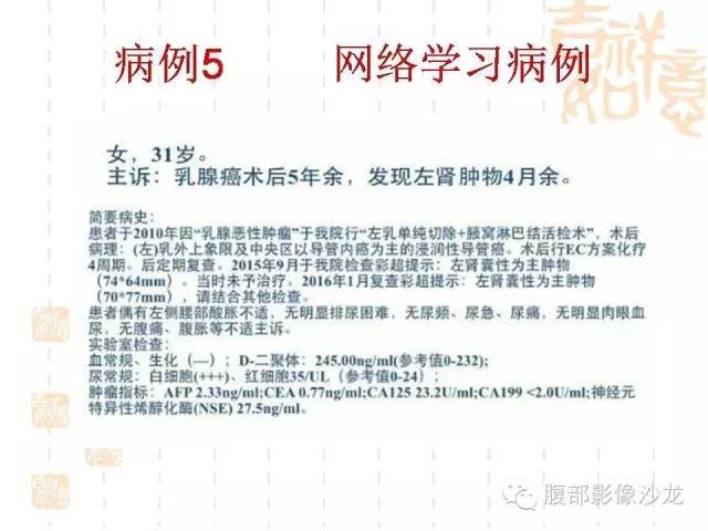 【PPT】肾囊实性病变分析 【PPT】肾囊实性病变分析