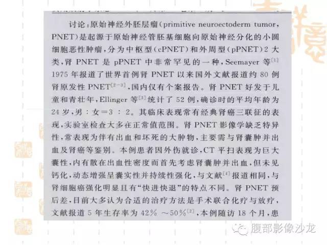 【PPT】肾囊实性病变分析 【PPT】肾囊实性病变分析