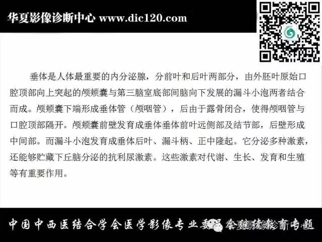 【PPT】鞍内常见病变的诊断