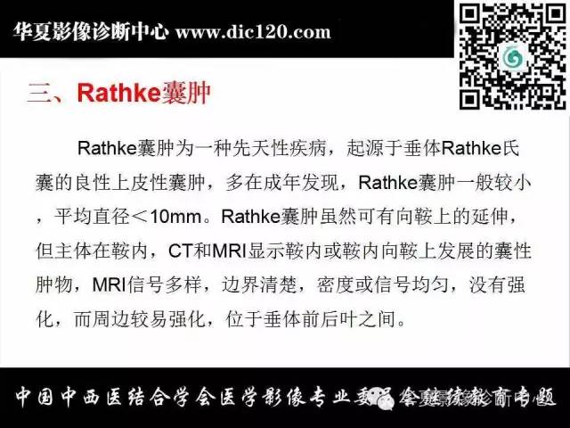 【PPT】鞍内常见病变的诊断