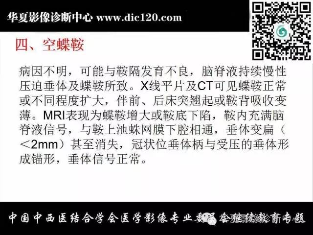 【PPT】鞍内常见病变的诊断