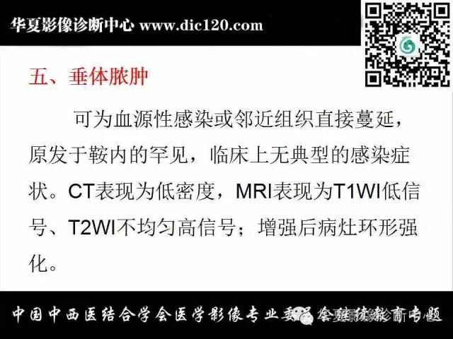 【PPT】鞍内常见病变的诊断