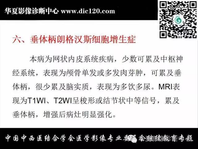 【PPT】鞍内常见病变的诊断