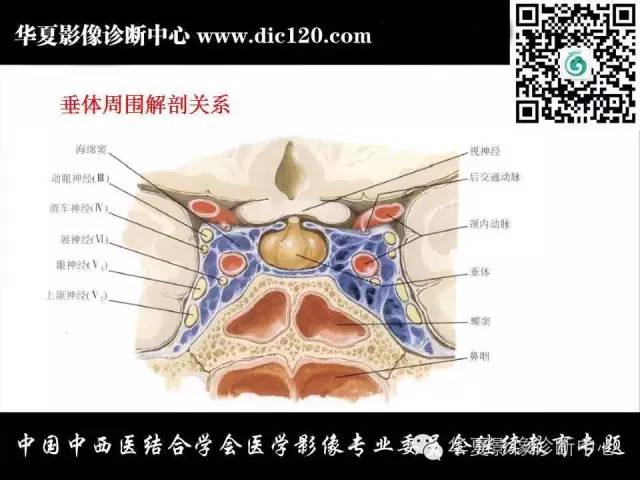 【PPT】鞍区周围常见病变的影像诊断
