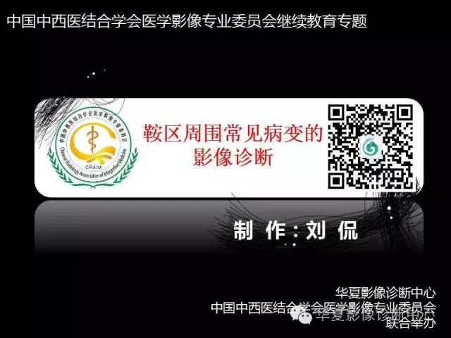 【PPT】鞍区周围常见病变的影像诊断