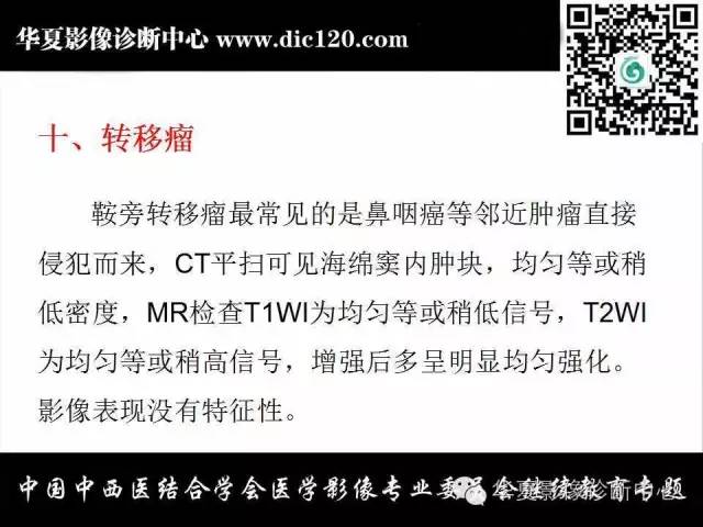 【PPT】鞍区周围常见病变的影像诊断