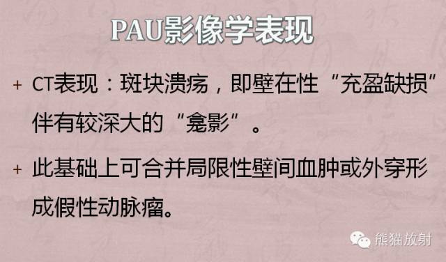 【PPT】急性主动脉综合征(AAS)