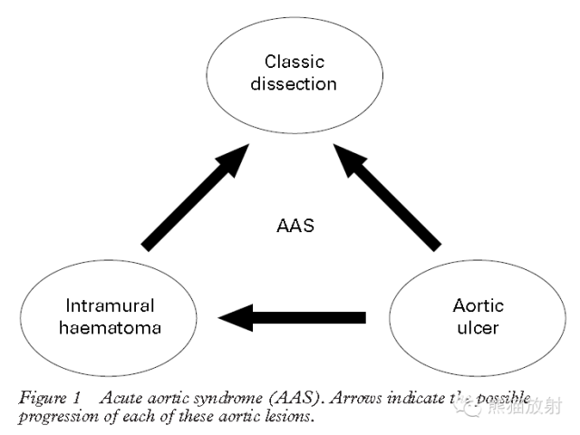 【PPT】急性主动脉综合征(AAS)