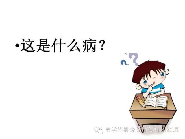 【病例】泪腺多形性腺瘤1例CT及MR影像表现