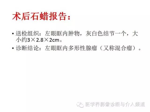 【病例】泪腺多形性腺瘤1例CT及MR影像表现