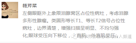 【病例】泪腺多形性腺瘤1例CT及MR影像表现