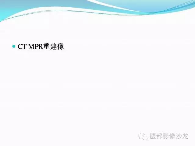 【病例】胃窦中分化腺癌1例CT影像表现 【病例】胃窦中分化腺癌1例CT影像表现