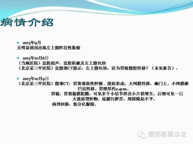 【病例】胃窦中分化腺癌1例CT影像表现 【病例】胃窦中分化腺癌1例CT影像表现