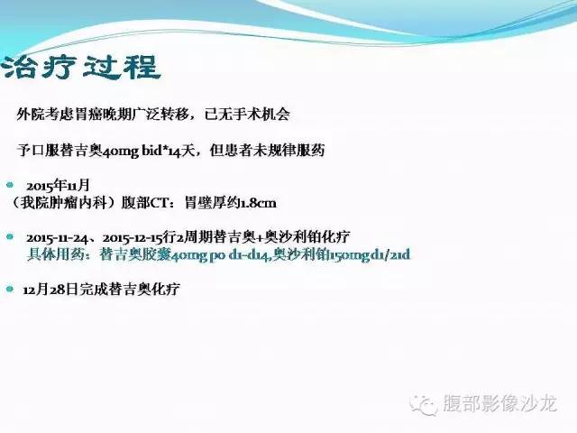 【病例】胃窦中分化腺癌1例CT影像表现 【病例】胃窦中分化腺癌1例CT影像表现