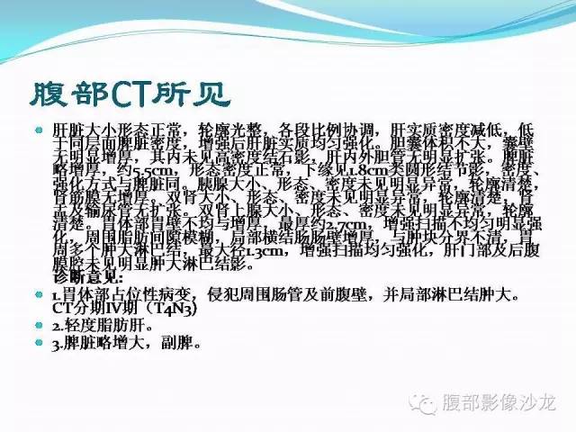 【病例】胃窦中分化腺癌1例CT影像表现 【病例】胃窦中分化腺癌1例CT影像表现