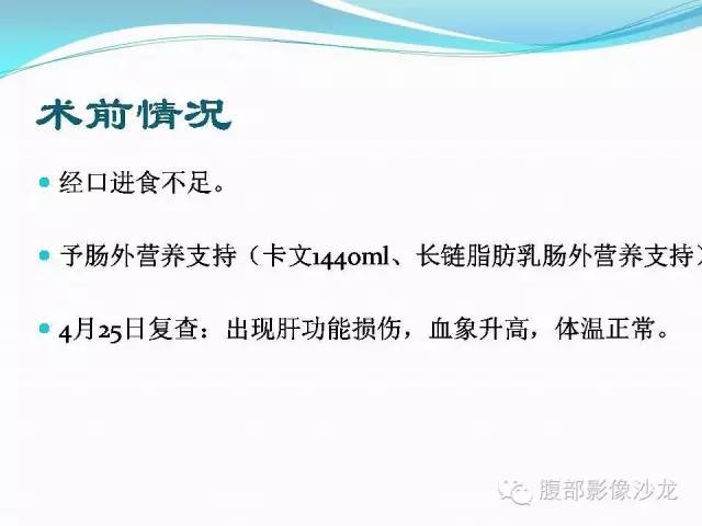 【病例】胃窦中分化腺癌1例CT影像表现 【病例】胃窦中分化腺癌1例CT影像表现
