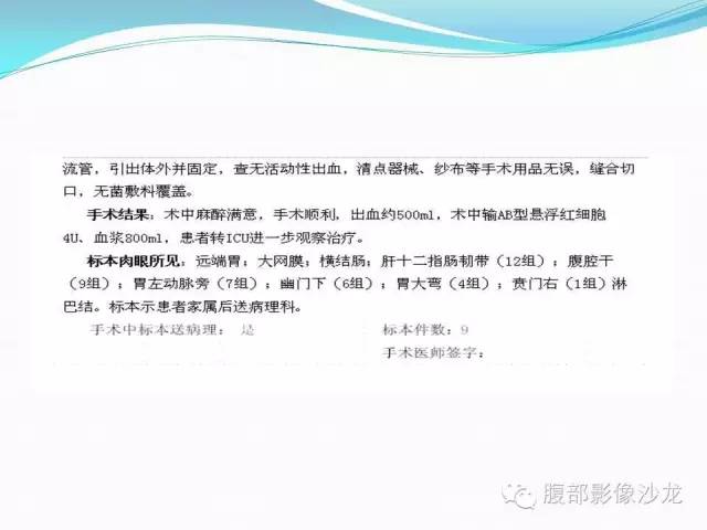 【病例】胃窦中分化腺癌1例CT影像表现 【病例】胃窦中分化腺癌1例CT影像表现