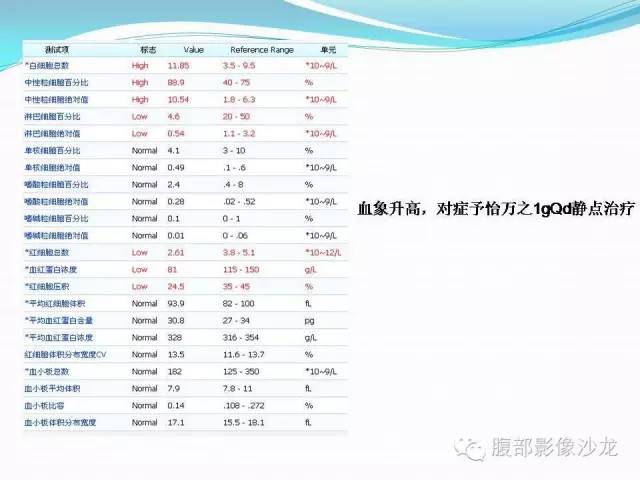 【病例】胃窦中分化腺癌1例CT影像表现 【病例】胃窦中分化腺癌1例CT影像表现