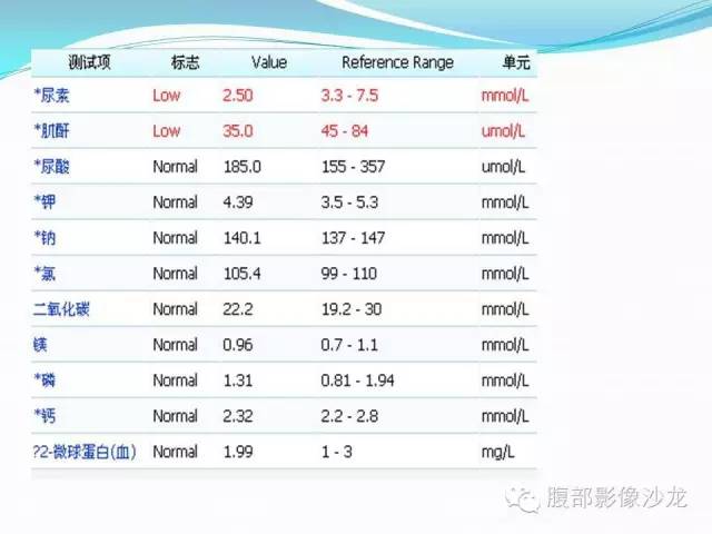 【病例】胃窦中分化腺癌1例CT影像表现 【病例】胃窦中分化腺癌1例CT影像表现