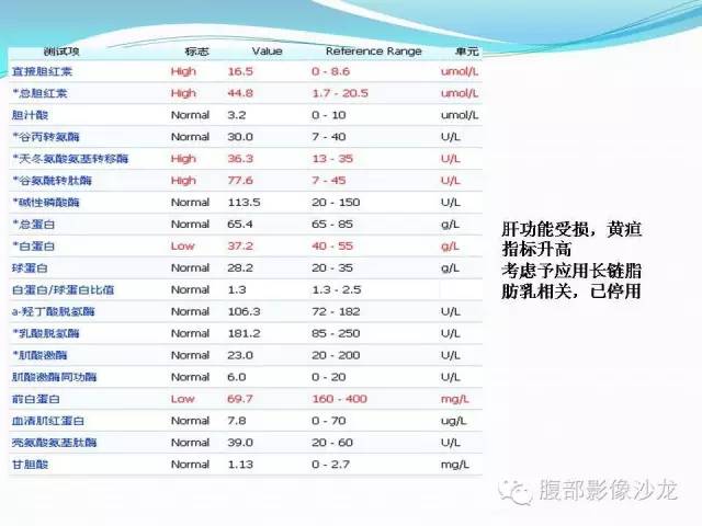 【病例】胃窦中分化腺癌1例CT影像表现 【病例】胃窦中分化腺癌1例CT影像表现