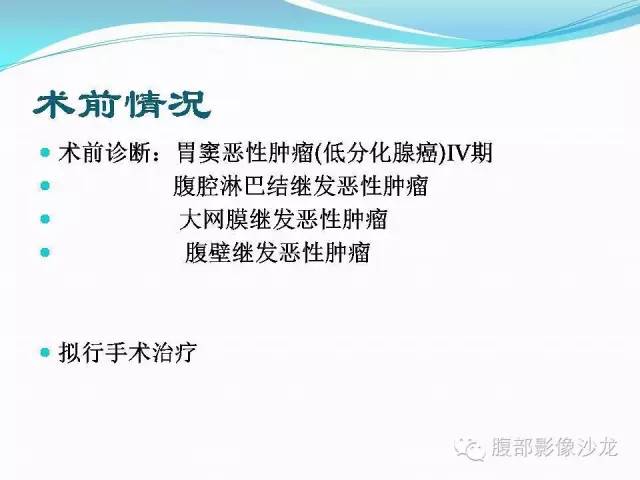 【病例】胃窦中分化腺癌1例CT影像表现 【病例】胃窦中分化腺癌1例CT影像表现