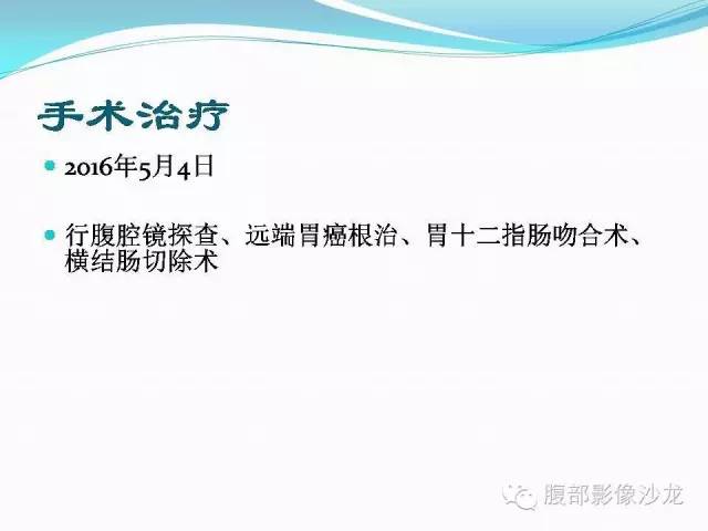 【病例】胃窦中分化腺癌1例CT影像表现 【病例】胃窦中分化腺癌1例CT影像表现