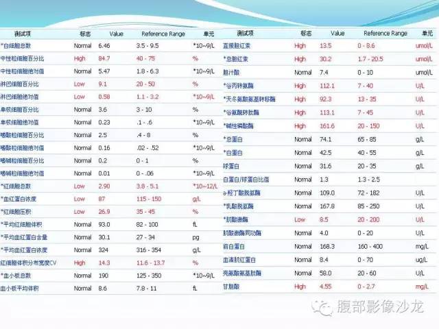 【病例】胃窦中分化腺癌1例CT影像表现 【病例】胃窦中分化腺癌1例CT影像表现