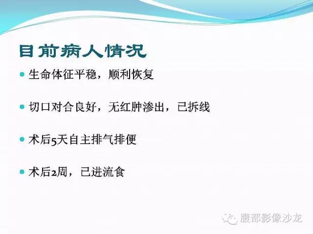 【病例】胃窦中分化腺癌1例CT影像表现 【病例】胃窦中分化腺癌1例CT影像表现