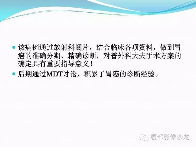 【病例】胃窦中分化腺癌1例CT影像表现 【病例】胃窦中分化腺癌1例CT影像表现