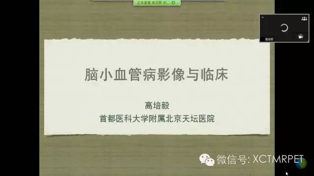 【PPT】脑小血管病影像与临床