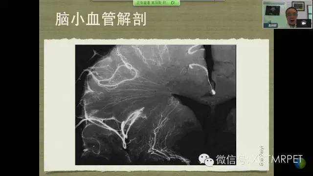 【PPT】脑小血管病影像与临床
