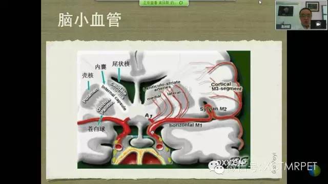 【PPT】脑小血管病影像与临床