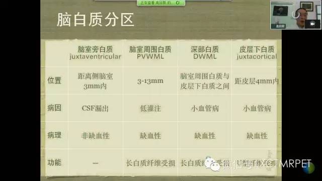 【PPT】脑小血管病影像与临床