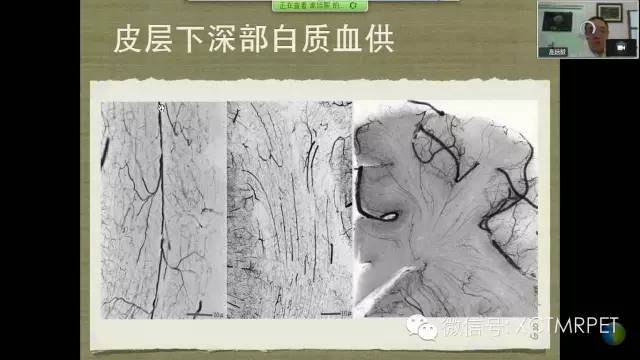 【PPT】脑小血管病影像与临床
