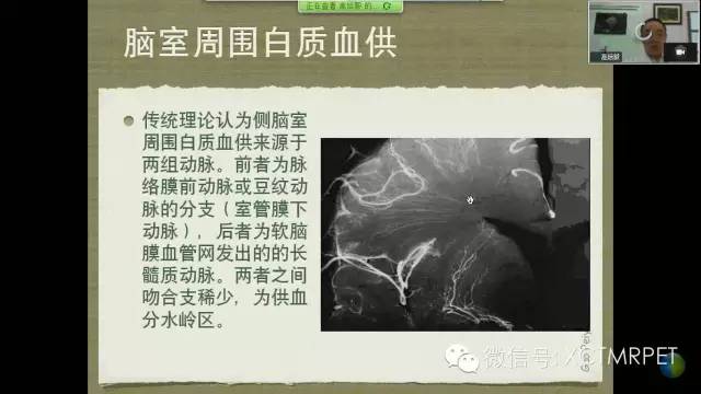 【PPT】脑小血管病影像与临床
