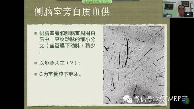 【PPT】脑小血管病影像与临床