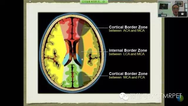 【PPT】脑小血管病影像与临床