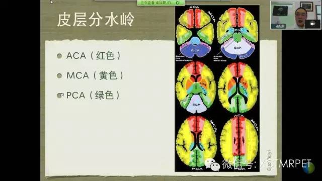 【PPT】脑小血管病影像与临床