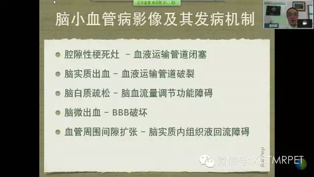 【PPT】脑小血管病影像与临床