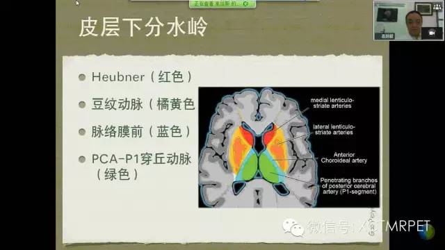 【PPT】脑小血管病影像与临床